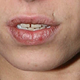 Illustration for article titled Paging Dr. Jezebel: Does Amy Winehouse Have Oral Cancer?
